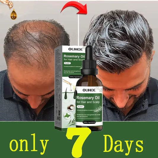Rosemary Hair Growth Oil Anti Hair Loss Strengthening Scalp Care