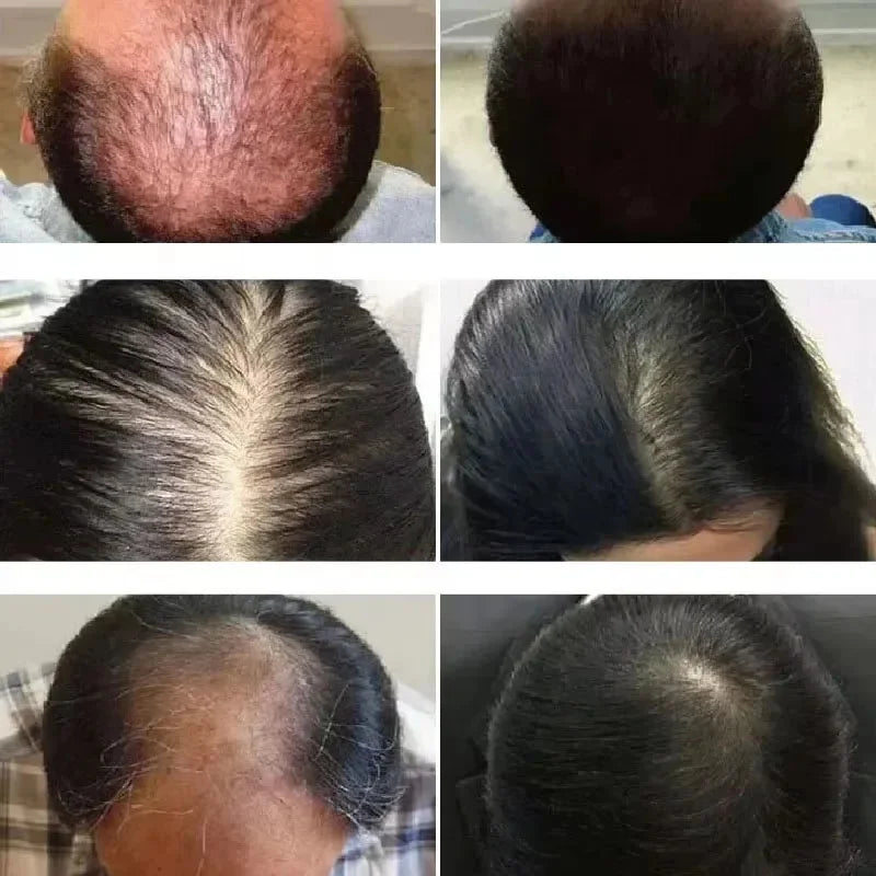 Rosemary Hair Growth Oil Anti Hair Loss Strengthening Scalp Care